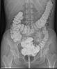Colon2.jpg