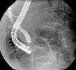 ERCP.jpg
