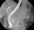 ERCP1.jpg